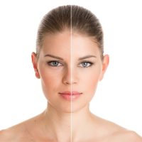 Skin Rejuvenation Treatment in Noida